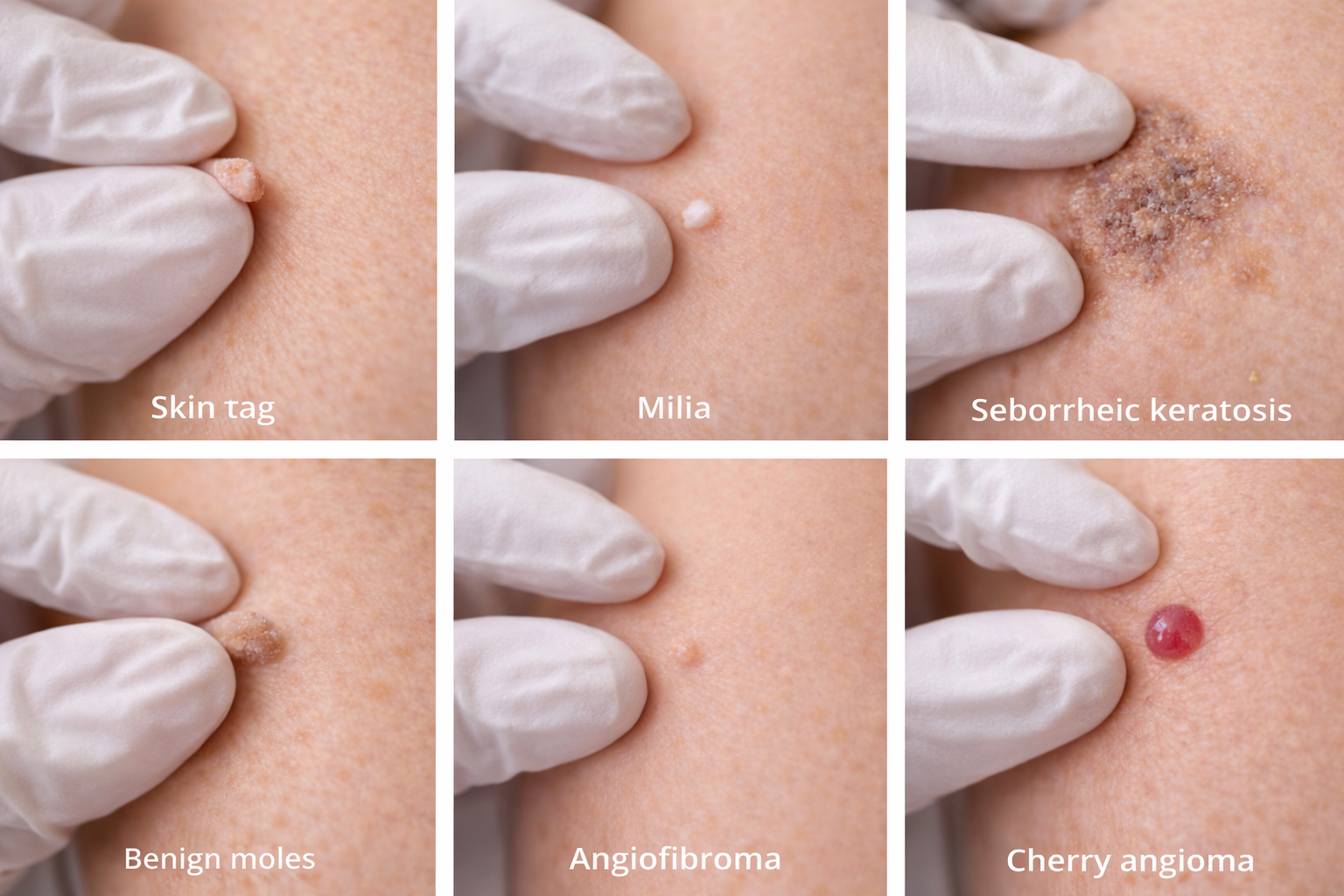A range of common skin concerns, considered individually